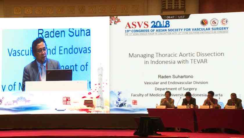 Raden Suhartono：Managing Thoracic Aortic Dissection in Indonesia with TEVAR